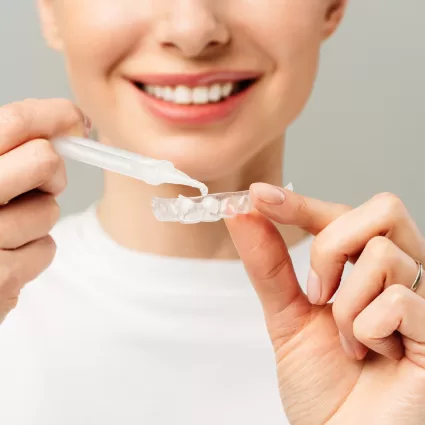 Teeth Whitening